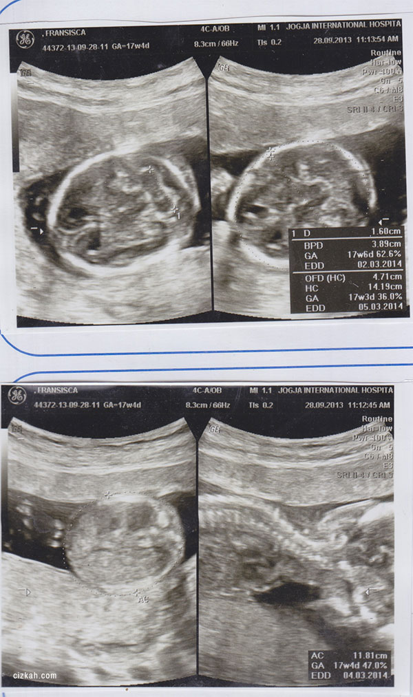 17weeks4days